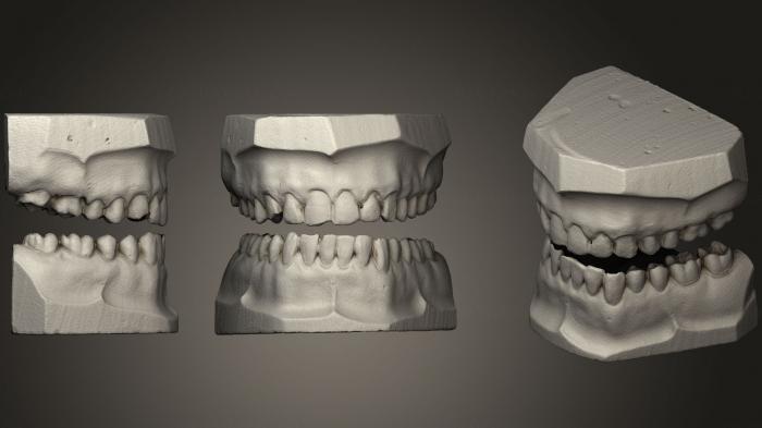 نموذج ثلاثي الأبعاد لآلة CNC تشريح الهياكل العظمية والجماجم أسنان الجبس
